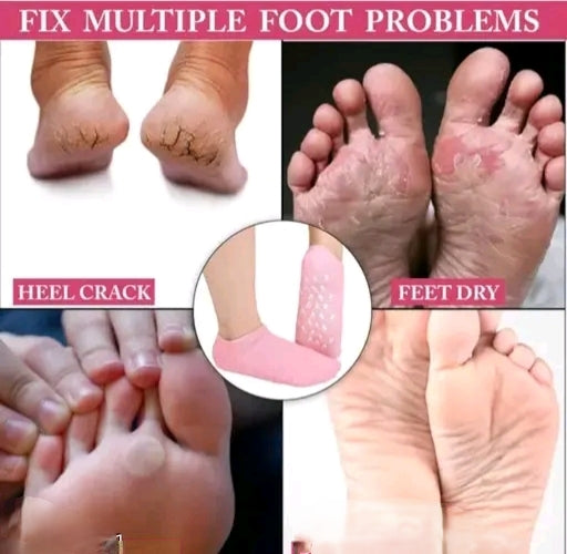 Moisturizing Spa Gel Socks for Cracked Heels – Soft & Smooth Feet